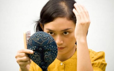 Nguyên nhân không ngờ khiến tóc rụng từng mảng, hói đầu