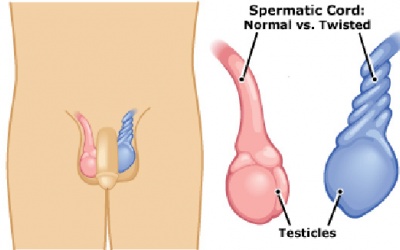 Giờ vàng để cứu… tinh hoàn!