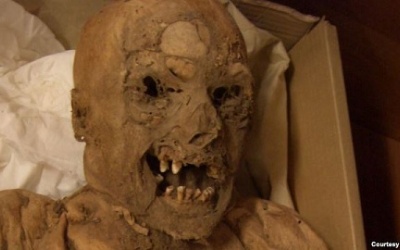 Xác ướp từ thế kỷ 18: Tiết lộ nguyên nhân mắc ung thư trực tràng