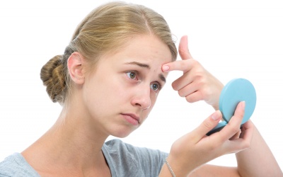 Nổi mụn, dị ứng do dùng mỹ phẩm có nên dùng kem thảo dược Azacné?