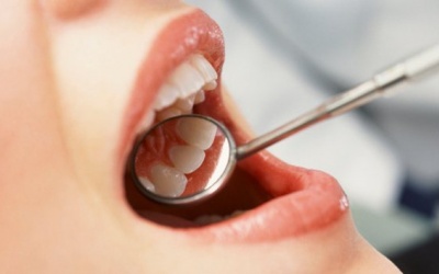 7 loại thực phẩm giúp ngăn ngừa chảy máu chân răng