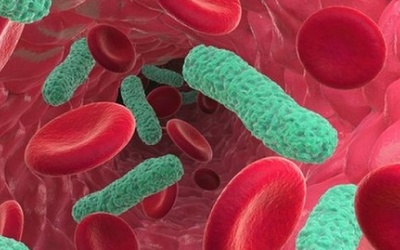 Nhiễm trùng máu là gì?