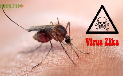 Virus Zika, tật đầu nhỏ ở trẻ, viêm tủy ở người lớn liên quan thế nào?