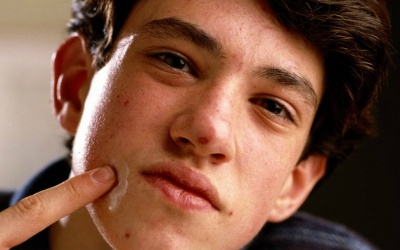 Đã không bị thì thôi, nam giới bị mụn còn... ghê hơn nữ giới