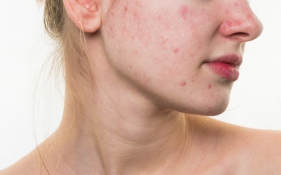 Nhìn da đoán bệnh chuẩn đến giật mình