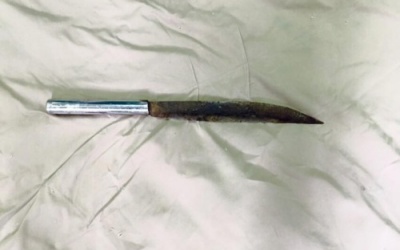 Dao nhọn đâm sâu 4 cm vào đầu thai phụ