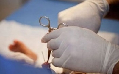 Có nên cắt bao quy đầu cho trẻ mới sinh?