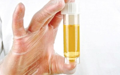 Cải thiện tình trạng nhiễm trùng đường tiểu nhờ các liệu pháp thảo dược sau