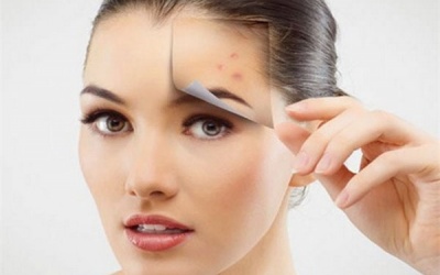 Muốn đánh bay sẹo thâm hãy dùng ngay cách này