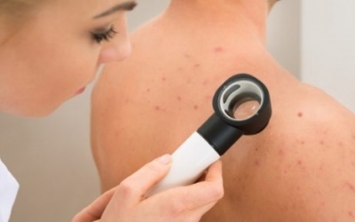 Những điều nên tránh khi bị viêm nang lông