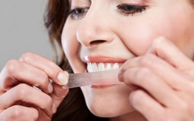 Tẩy trắng răng tại nhà quá nhiều có an toàn không?