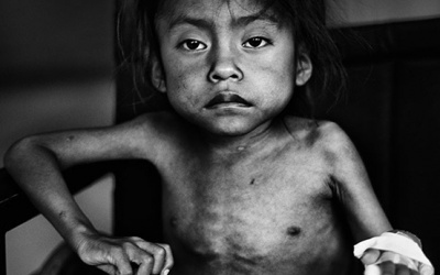 Hít thở, động chạm cũng có thể bị nhiễm độc chì