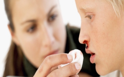 Tại sao chảy máu cam tuyệt đối không được ngửa đầu ra sau?