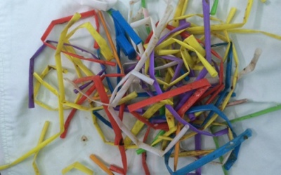 Gắp gần 50 chiếc ống hút trong dạ dày người đàn ông