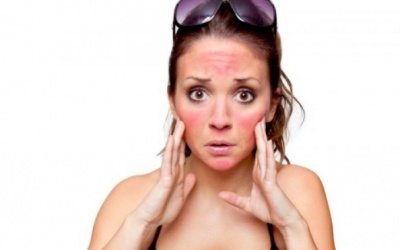 Cấp cứu làn da cháy nắng nhờ các liệu pháp sau