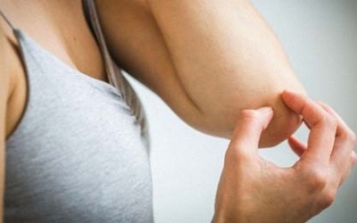 Làm thế nào để bớt ngứa ngáy do vẩy nến?