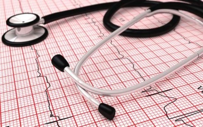 Những điều cần biết về rung tâm nhĩ - Rối loạn nhịp tim bất thường