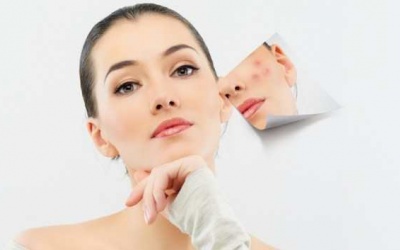 7 cách đơn giản để ngăn chặn mụn tái phát