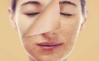 Tự làm mặt nạ cho da sạm màu