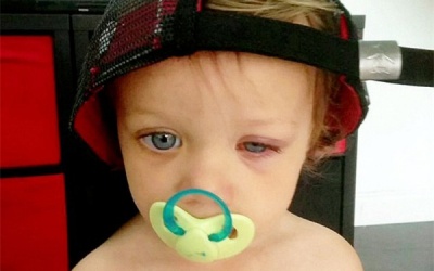 Bé gái 18 tháng tuổi suýt bị mù vì thứ nước hóa chất các gia đình dùng hàng ngày