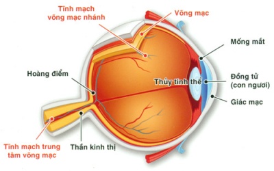 Mất thị giác do tắc tĩnh mạch võng mạc