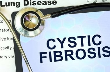 7 Triệu chứng chính của bệnh xơ nang