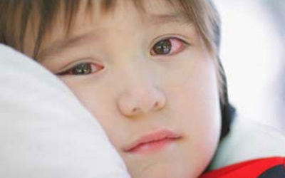 Bé 3 tuổi bị hỏng mắt vì mẹ thích sành điệu: Bài học cho nhiều gia đình