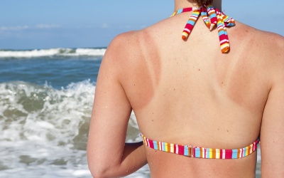 Nguyên nhân bất ngờ khiến kem chống nắng bị giảm tác dụng