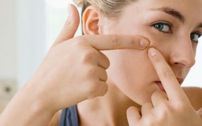 Mụn đầu đen mọc 'kín mặt' vì những nguyên nhân không ngờ!