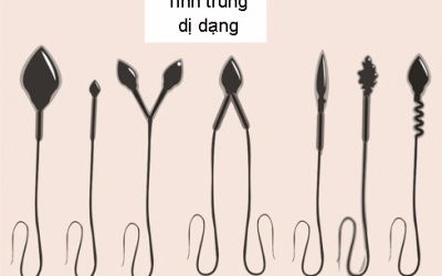 Ngày nào cũng nếm rượu, người đàn ông sở hữu hàng triệu tinh binh què quặt