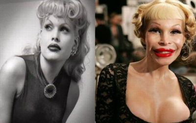 Thèm khát phẫu thuật thẩm mỹ tố cáo bạn mắc căn bệnh này