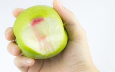 5 biện pháp đơn giản giúp điều trị chảy máu nướu răng