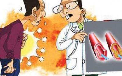 Những dấu hiệu nhận biết xơ vữa động mạch