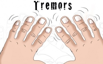 Run vô căn và những vấn đề người bệnh cần nắm rõ