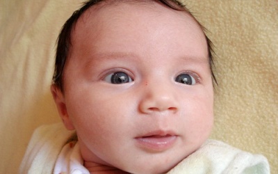 Dấu hiệu nhận biết trẻ bị lác mắt