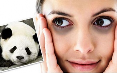 Thực hư chuyện người “số khổ” có quầng thâm ở mắt