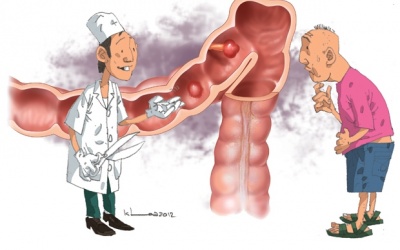 Tầm soát ung thư đại trực tràng ngay nếu xuất hiện những dấu hiệu này!