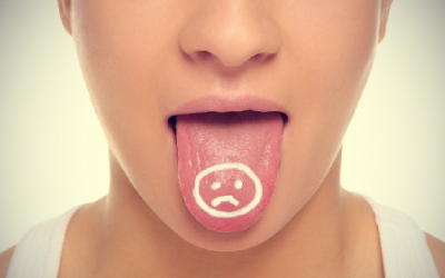 8 nguyên nhân gây viêm loét lưỡi bạn nên biết