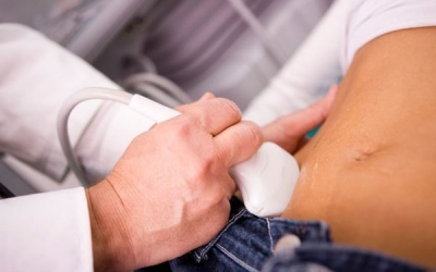 Bị buồng trứng đa nang có nên uống thuốc điều kinh?