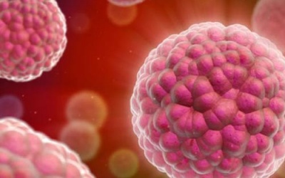 Tiêu diệt tế bào ung thư bằng điện trường