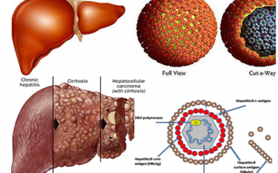 WHO quan ngại về tỷ lệ nhiễm virus viêm gan B, C ở Việt Nam