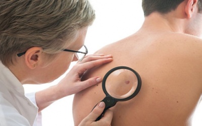 Những dấu hiệu ung thư ít để ý nhất