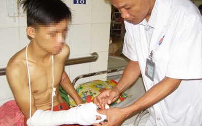 Nối thành công bàn tay đứt lìa do tai nạn giao thông