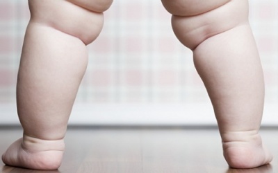 Sinh mổ khiến trẻ tăng nguy cơ bị béo phì