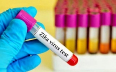 Zika - Những nguy cơ còn ít người biết đến