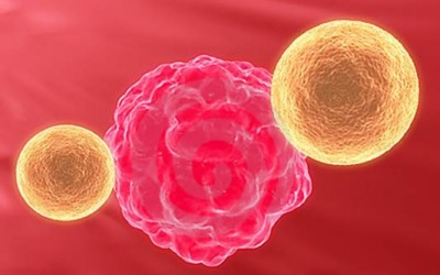 Béo phì có nguy cơ cao bị 8 loại ung thư