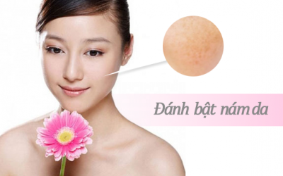 Ăn uống cũng giảm nám da – Không tin thì hãy đọc!