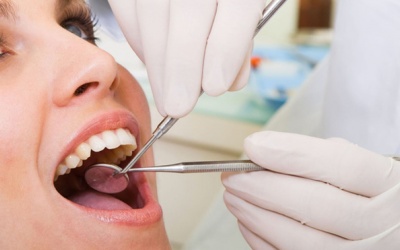 Có nên nhổ răng khôn?