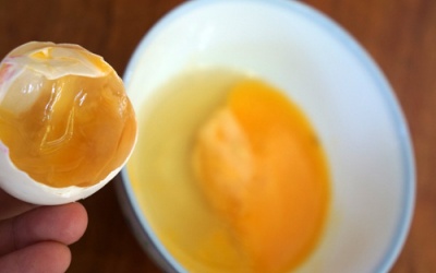 Khí trứng thối: Bảo vệ người đái tháo đường khỏi biến chứng tim mạch