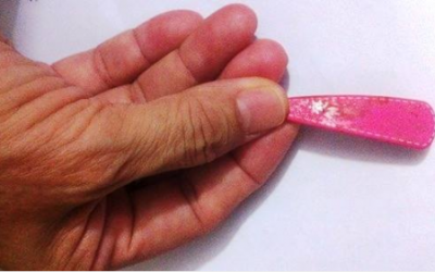 Dị vật trong vùng kín khiến bé gái “như bị xâm hại”